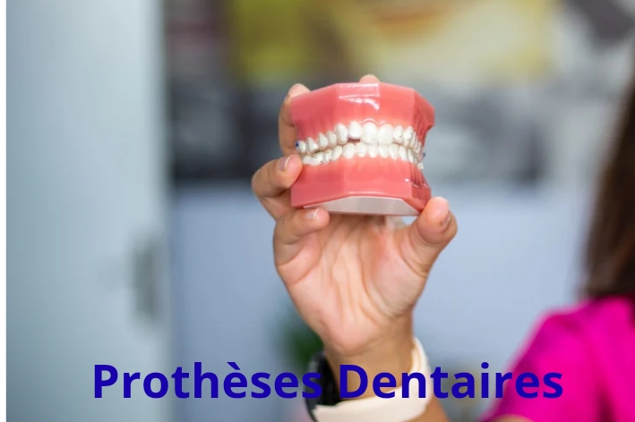 Prothèses dentaires