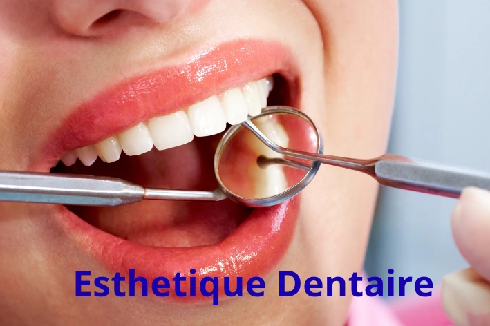 Esthétique dentaire